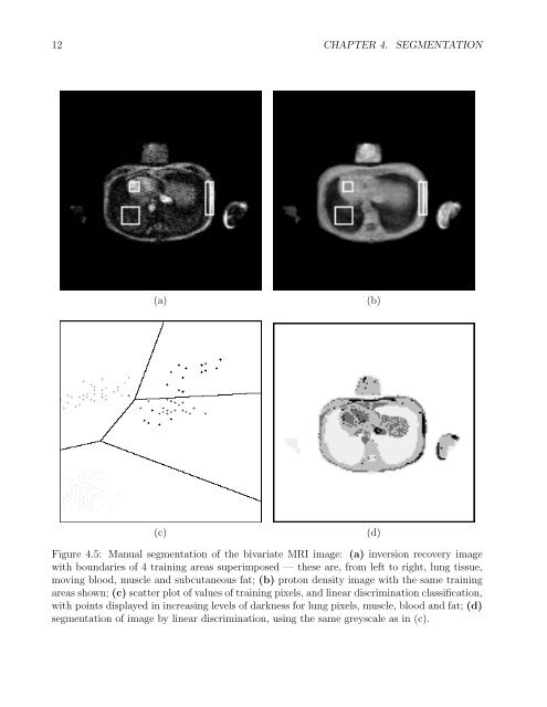 Chapter 4 SEGMENTATION