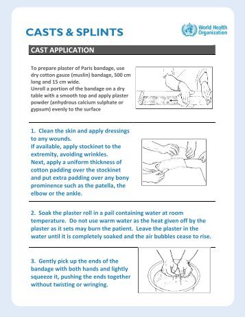 Casts and Splints