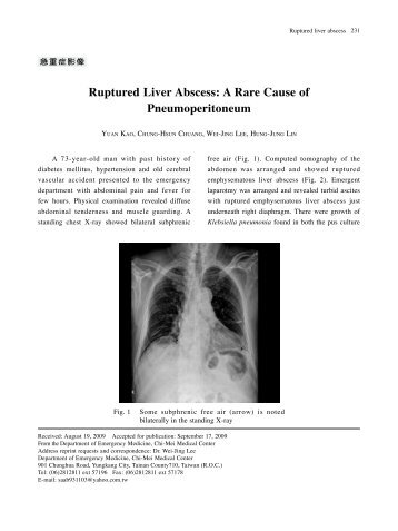 Ruptured Liver Abscess: A Rare Cause of Pneumoperitoneum