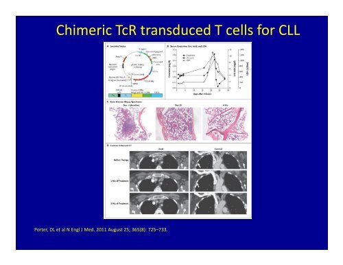 Tumor-infiltrating lymphocyte (TIL) - Winship Cancer Institute of ...