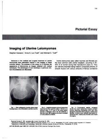 Imaging of Uterine Leiomyomas