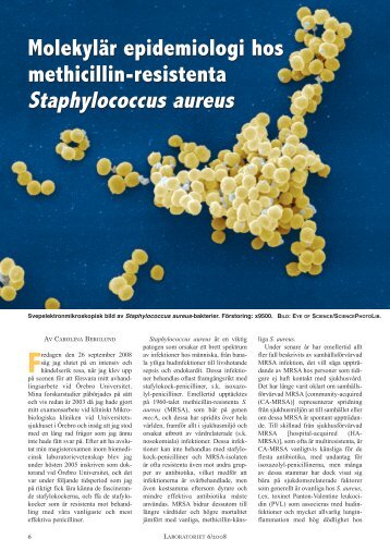 Staphylococcus aureus Staphylococcus aureus