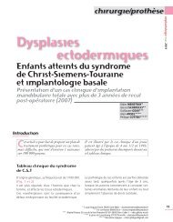 Dysplasies Ectodermiques: enfants atteints du syndrome de Christ ...