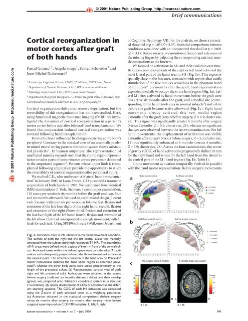 Cortical reorganization in motor cortex after graft of both hands