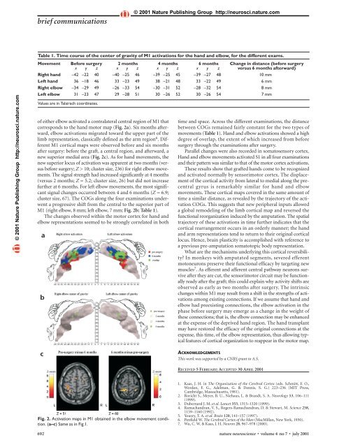 Cortical reorganization in motor cortex after graft of both hands