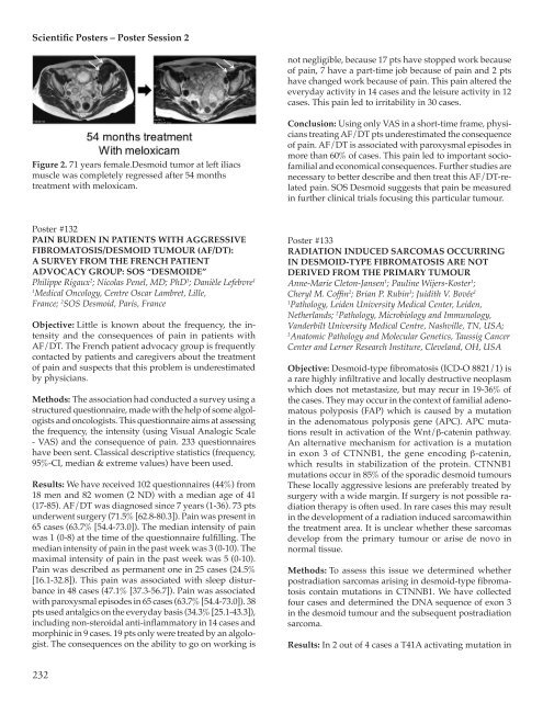 207 Poster Session 2 - Connective Tissue Oncology Society