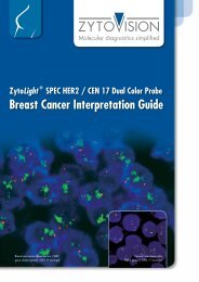 Breast Cancer Interpretation Guide - AH diagnostics