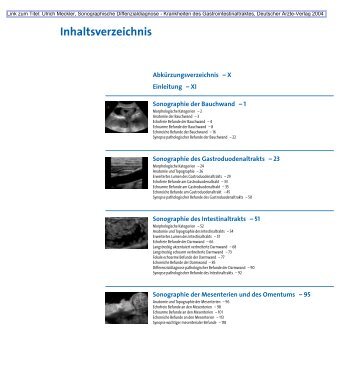 Sonographische Differenzialdiagnose - Deutscher Ärzte-Verlag