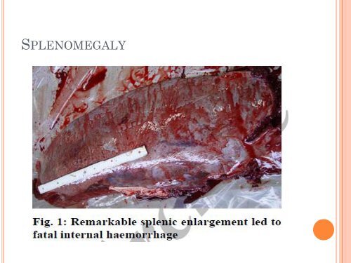 group 4 SPLEEN - UMK CARNIVORES 3