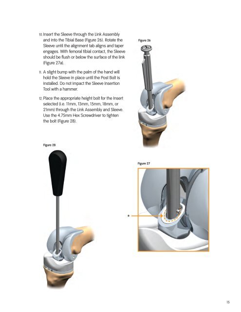 LEGION HK Dis and Re-Assembly Tech.pdf - Bonerepmedical.com