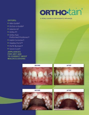 Ortho-Tain Main Catalog - ProSites