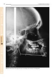 Gebiss- en twicklung Te rminologie Modellanalyse K ephalometrie ...