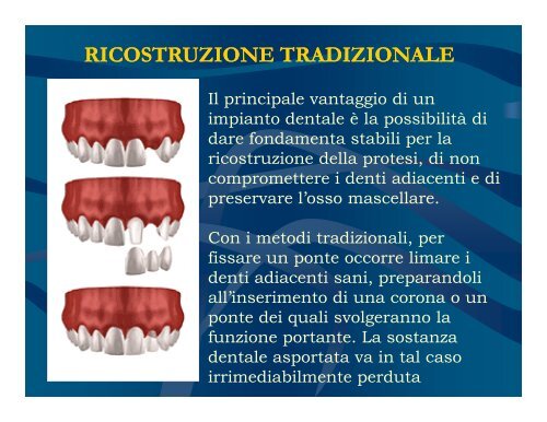 (Microsoft PowerPoint - Denti FINAL2.ppt [modalit\340 compatibilit ...