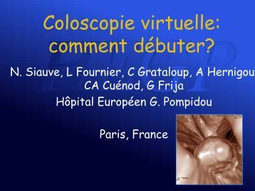 Coloscopie virtuelle: comment dÃ©buter? - SFR