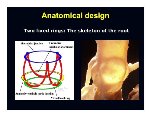 aortic valve and aortic valve and aortic root anatomy - Sha ...