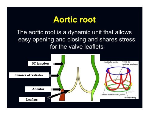 aortic valve and aortic valve and aortic root anatomy - Sha ...