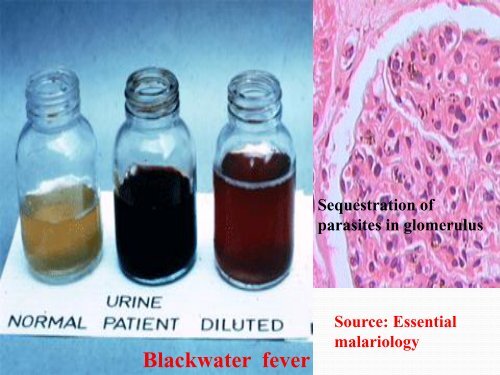 The pathology of malaria