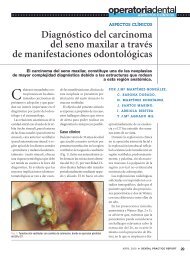 DiagnÃ³stico del carcinoma del seno maxilar a travÃ©s de ...