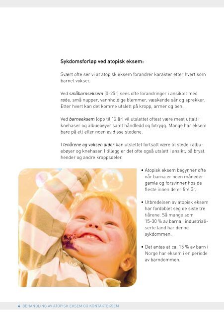 eksemet. For at behandling - Norges Astma- og Allergiforbund