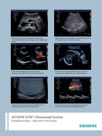 ACUSON X150 Clinical Images 3.19MB - Siemens Healthcare