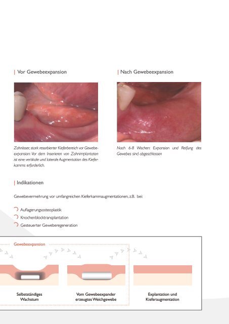 Osmed Brochure dental