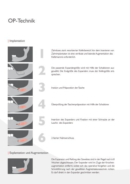 Osmed Brochure dental