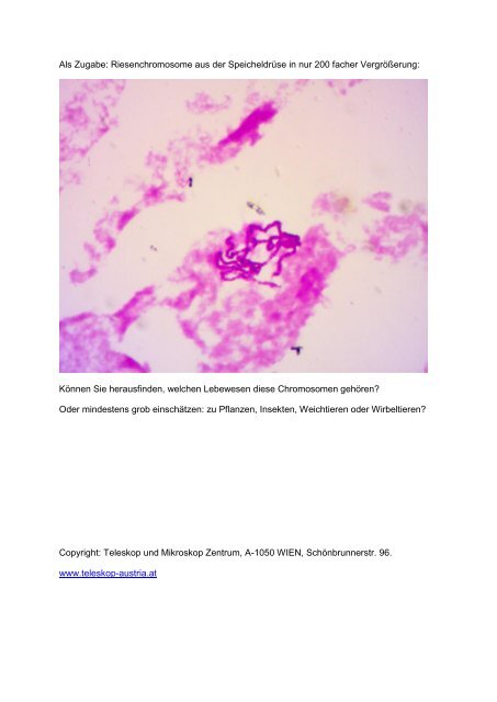 Chromosomen - Teleskop