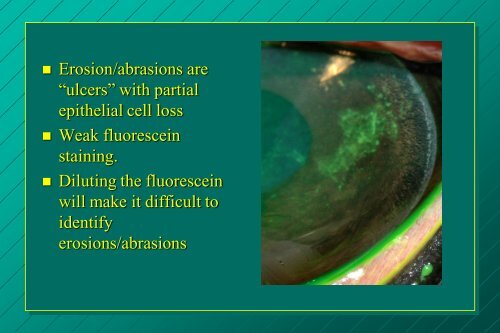 examination of the eye: methods of diagnosis and instrumentation