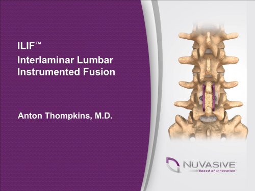 ILIF Interlaminar Lumbar Instrumented Fusion