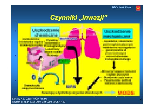 Wentylacja nieinwazyjna i rÃ³Å¼ne formy jej klinicznego zastosowania ...