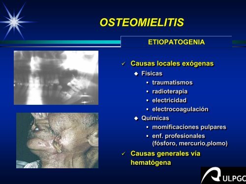 Tratamiento