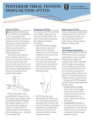 POSTERIOR TIBIAL TENDON DYSFUNCTION (PTTD)