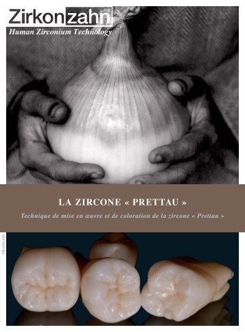 Coloration de la zircone Prettau - Zirkonzahn