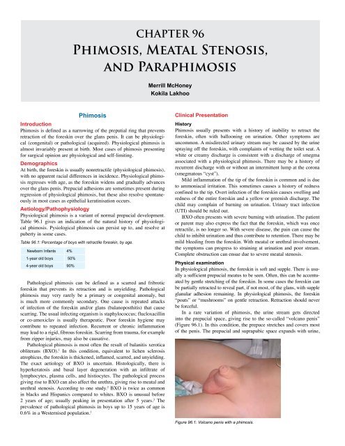 Phimosis and Paraphimosis In the ED: Practice Essentials, Epidemiology,  Prognosis