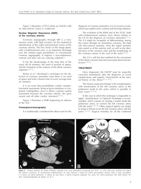 Anomalous Origin of Coronary Arteries