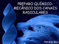 MODELAGEM DOS CANAIS RADICULARES - PatrÃ­cia Ruiz Spyere