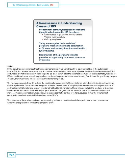 The Pathophysiology of Irritable Bowel SyndromeCME - Medscape