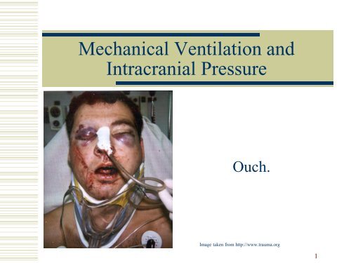 Mechanical Ventilation and Intracranial Pressure