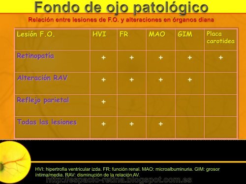 Interpretación de la Retinografía digital y F.O