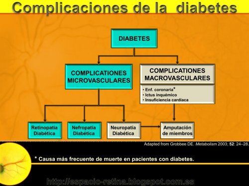 Interpretación de la Retinografía digital y F.O