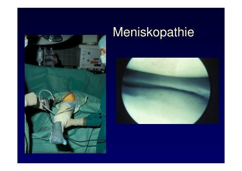 Vorlesung Leitsymptom Das dicke Knie