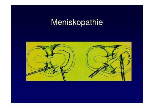 Vorlesung Leitsymptom Das dicke Knie