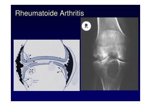 Vorlesung Leitsymptom Das dicke Knie