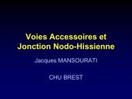 Voies Accessoires et Jonction Nodo-Hissienne