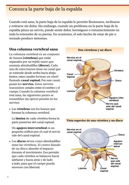 Laminectomía y laminotomía - Veterans Health Library