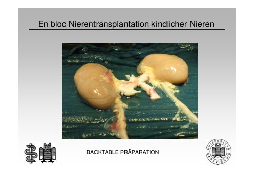 (Microsoft PowerPoint - M. Janssen - En bloc-Transplantation von S ...