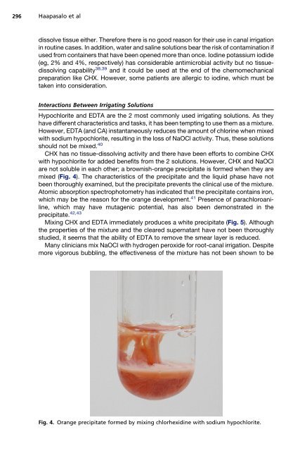 Irrigation in Endodontics - The Endoexperience