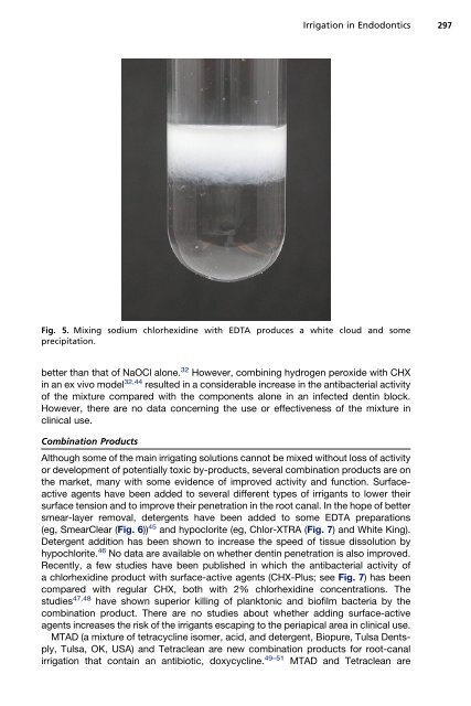 Irrigation in Endodontics - The Endoexperience