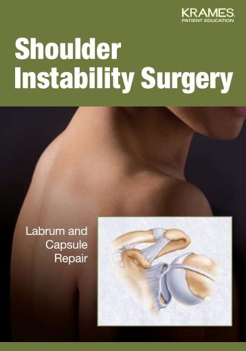 Shoulder Instability Surgery - Veterans Health Library