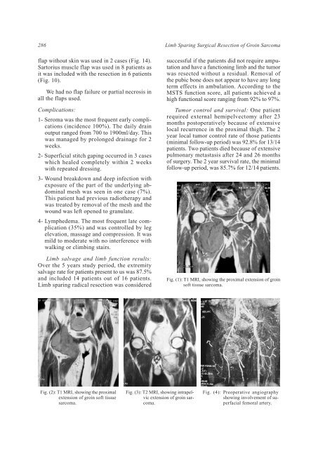 Limb Sparing Surgical Resection of Groin Sarcoma. Surgical ... - NCI